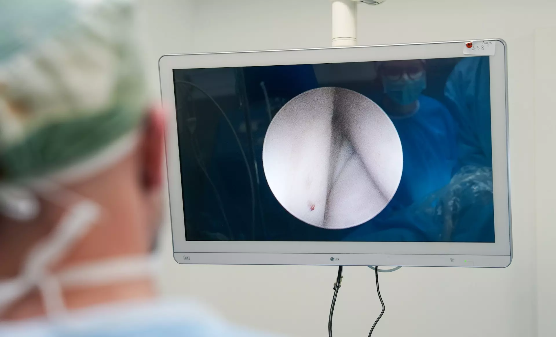 Endoskopische 4K-Live-Bildgebung während einer laparoskopischen Operation – Tierärztezentrum Neuland Bergheim